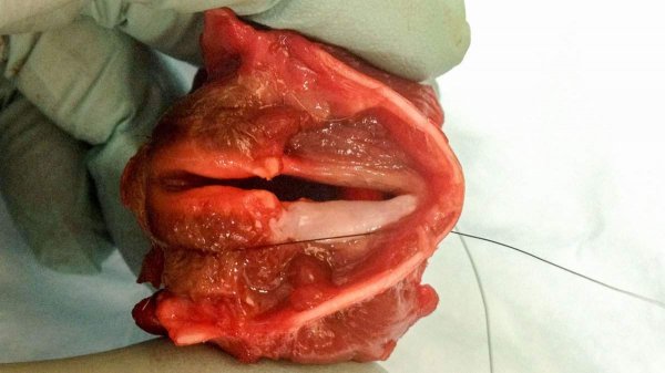 Lab-Grown Vocal Cord Tissue Vibrates and Generates Sound in Breakthrough Study
